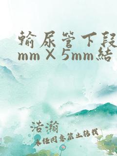 输尿管下段10mm×5mm结石怎么排出快