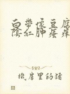 白带像豆腐渣外阴红肿瘙痒