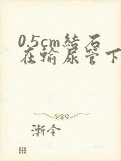 0.5cm结石在输尿管下段卡住怎么办