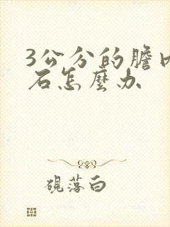 3公分的胆内结石怎么办