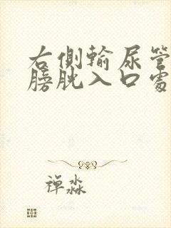 右侧输尿管末端膀胱入口处结石