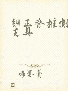 纠正脊椎侧弯的支具