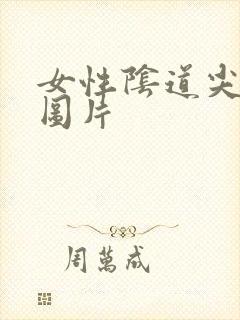 女性阴道尖疣湿图片