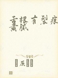 舌根有裂痕舌苔黄腻