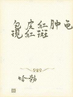 包皮红肿龟头出现红斑