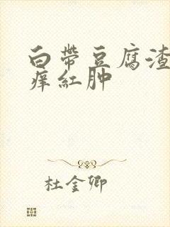 白带豆腐渣外阴痒红肿