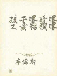 孩子眼睛眼屎多又黄粘稠眼睛红