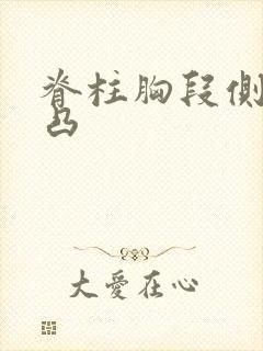 脊柱胸段侧弯右凸