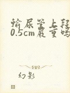 输尿管上段结石0.5cm严重吗