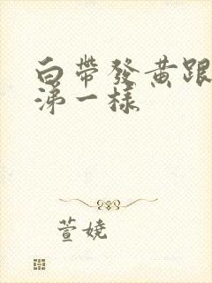 白带发黄跟脓鼻涕一样