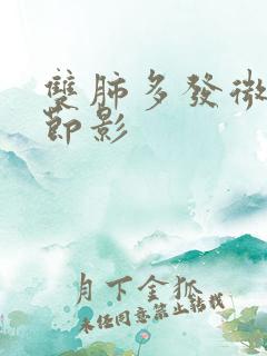 双肺多发微小结节影