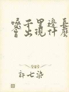 嗓子里边长息肉会出现什么症状