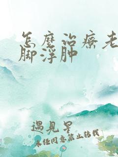 怎么治疗老年人脚浮肿