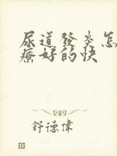 尿道发炎怎么治疗好的快