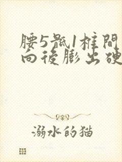 腰5骶1椎间盘向后膨出硬膜囊受压