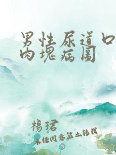 男性尿道口长小肉块病图