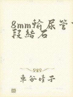 8mm输尿管下段结石