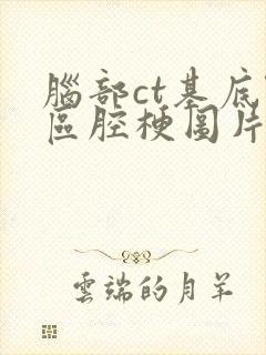 脑部ct基底节区腔梗图片