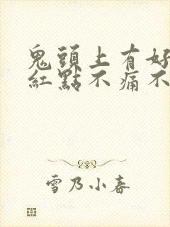 鬼头上有好多小红点不痛不痒