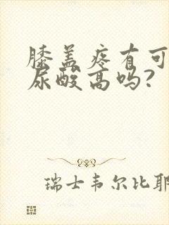 膝盖疼有可能是尿酸高吗?