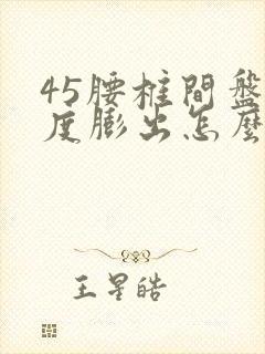 45腰椎间盘轻度膨出怎么治疗好?