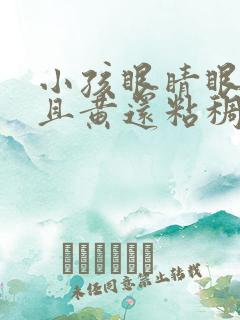 小孩眼睛眼屎多且黄还粘稠怎么办