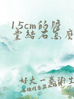 1.5cm的胆囊结石怎么治疗