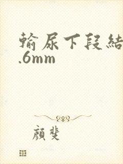 输尿下段结石0.6mm