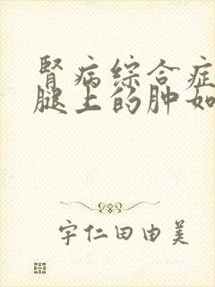 肾病综合症患者腿上的肿如何消除