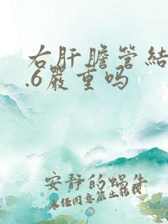 右肝胆管结石0.6严重吗