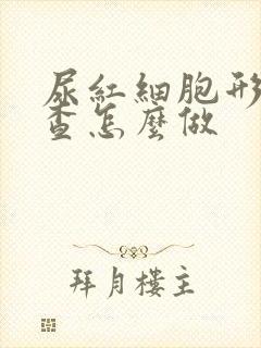 尿红细胞形态检查怎么做