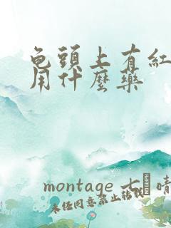 龟头上有红点痒用什么药