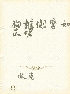 胸椎侧弯如何矫正呢