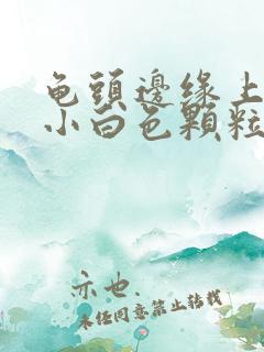 龟头边缘上面长小白色颗粒