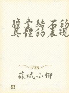 胆囊结石的症状具体的表现有哪些