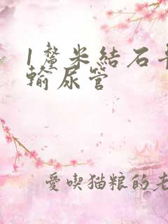 1厘米结石卡在输尿管