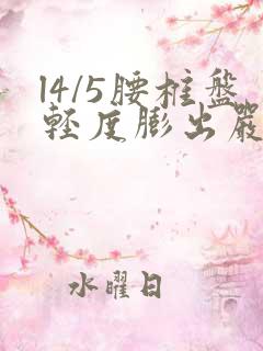 l4/5腰椎盘轻度膨出严重吗