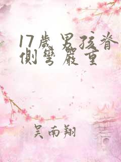 17岁男孩脊椎侧弯严重