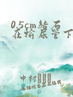 0.5cm结石在输尿管下段卡住怎么办