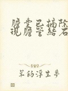 胆囊已摘除,发现胆管结石怎么办