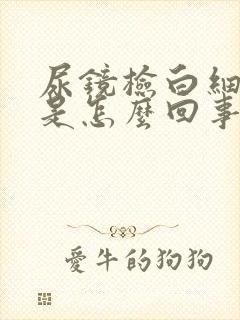 尿镜检白细胞高是怎么回事