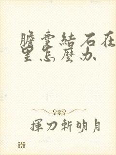 胆囊结石在胆管里怎么办