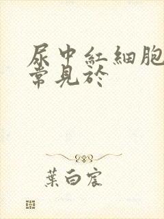 尿中红细胞管型常见于