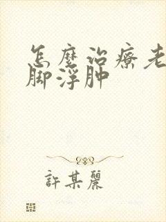 怎么治疗老年人脚浮肿