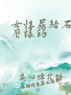 女性尿结石是什么样的