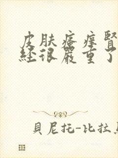 皮肤瘙痒肾病已经很严重了吗