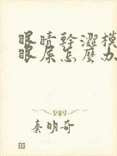 眼睛干涩模糊有眼屎怎么办