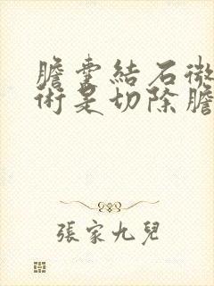 胆囊结石微创手术是切除胆囊吗