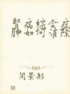 肾病综合症的水肿如何消除