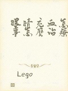 眼睛充血怎么回事怎么治疗